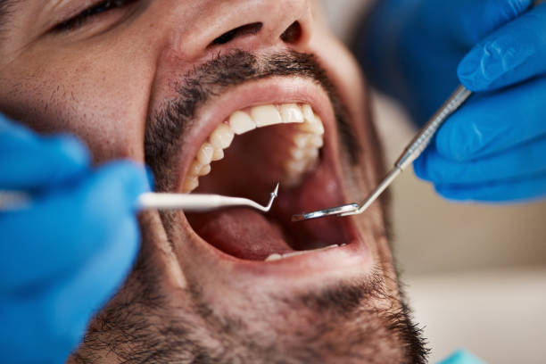 Best Oral Cancer Screening  in Gleed, WA